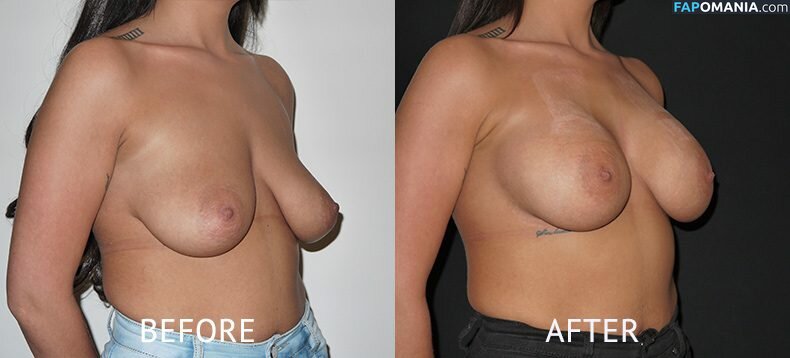 Imogen Townley Desnudo Foto filtrada #1